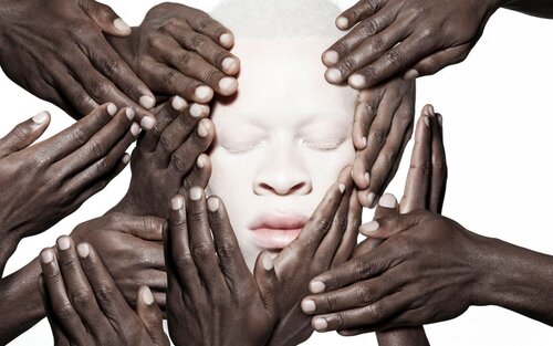 a group of hands around a person's face | © source: internet